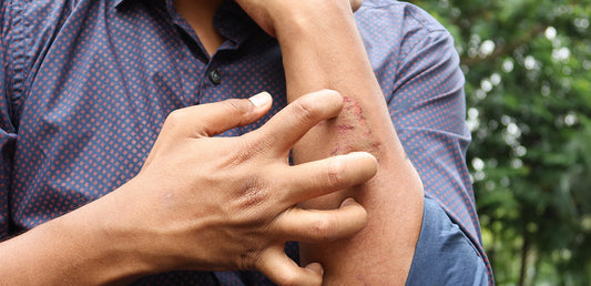 Scratching arm with rash