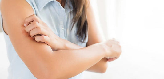 girl scratching rash on arm