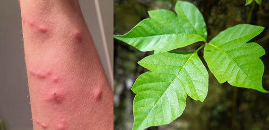 poison ivy rash next to poison ivy plant