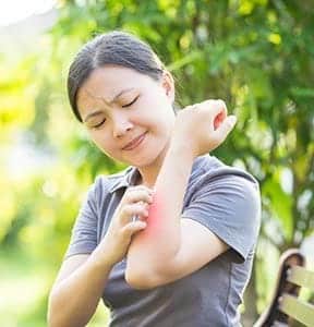 A woman scratching her arm due to Poison ivy rash.