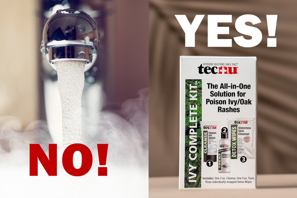 The image shows a comparison between using water ("NO!") and Tecnu's all-in-one kit ("YES!") for treating poison ivy or oak rashes.