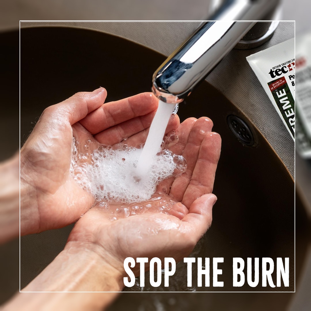 Hands being washed under a stream of water from a faucet, with soap lather forming in the palms. Text reads "STOP THE BURN.